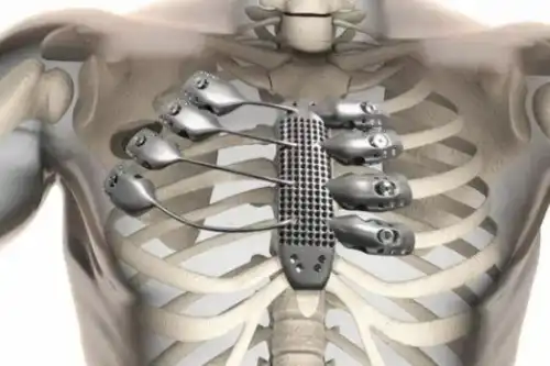 titanium alloy supplier titanium alloy supplier