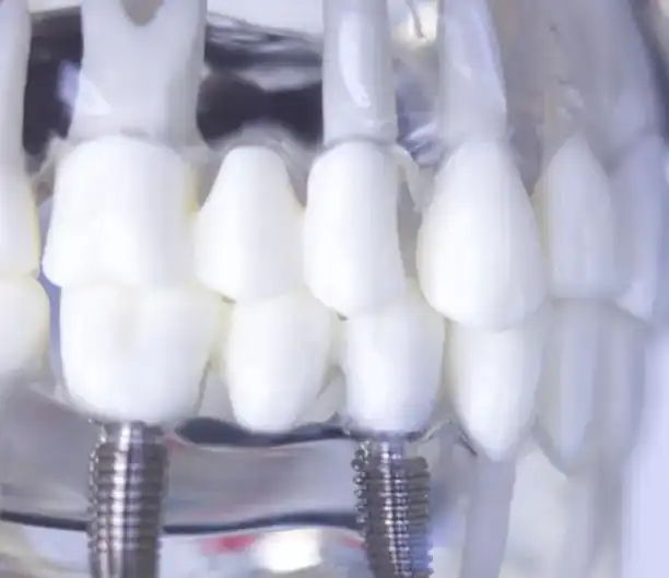 medical titanium rods supplier medical titanium rods supplier